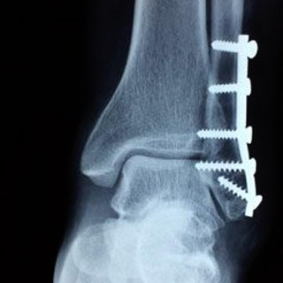 Cirugía ortopédica 